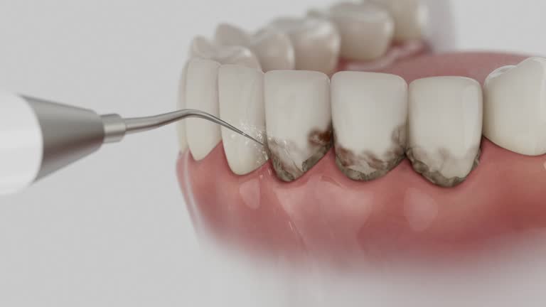 Reliable Dental contractor in Laurie, MO by Smile Center Dentistry